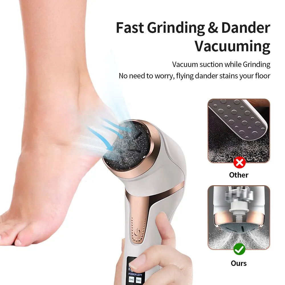 Electronic Foot Files Portable Electric Foot Callus Remover